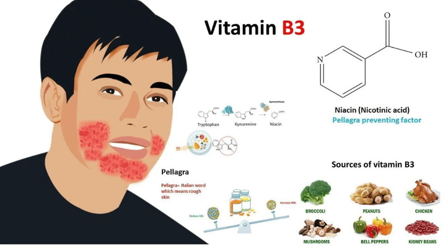 Niacin (vitamin B3)